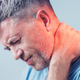 Illustration for article titled What causes neck pain?